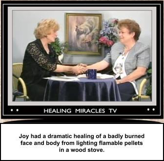 Joy had a dramatic healing of a badly burned face and body from lighting flamable pellets in a wood stove.